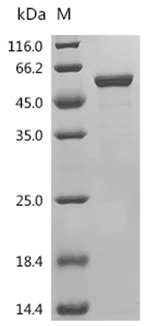 Recombinant Human Glutathione S-transferase kappa 1 (GSTK1), partial (CSB-EP009978HUf0)