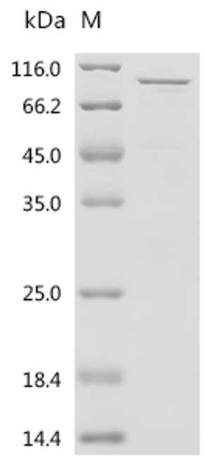 Recombinant Human Neurosecretory protein VGF (VGF) (CSB-EP025847HUc7)