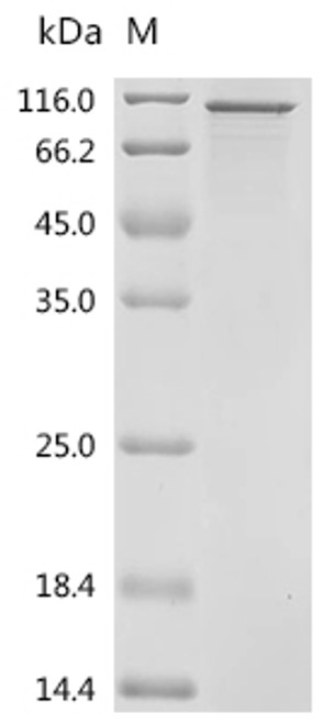 Recombinant Human Eukaryotic elongation factor 2 kinase (EEF2K) (CSB-EP007435HU)