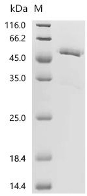 Recombinant Mouse Tumor necrosis factor ligand superfamily member 12 (Tnfsf12), partial (CSB-MP023987MO1)