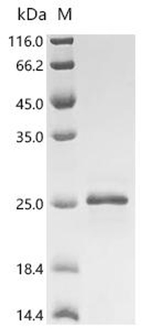 Recombinant Mouse Adenosine receptor A2a (Adora2a), partial (CSB-EP720158MO1)