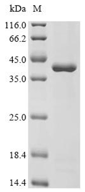 Recombinant Danio rerio Aerolysin-like protein (LOC795232) (CSB-EP6621DIL)