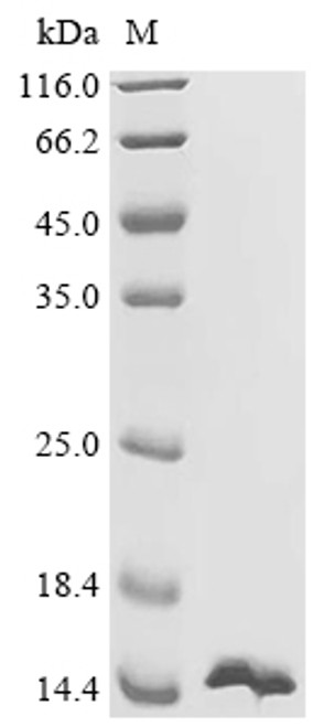 Recombinant Human Rho GTPase-activating protein 33 (ARHGAP33), partial (CSB-EP022371HU1b0)