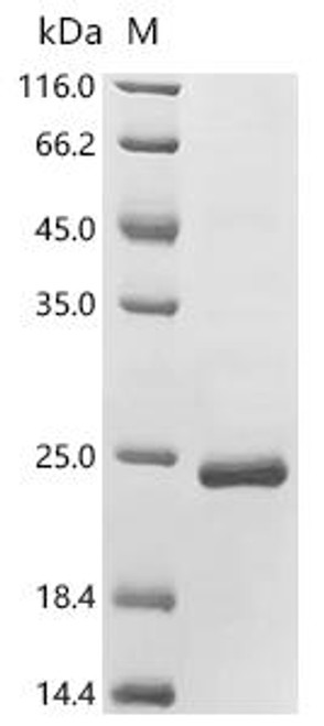 Recombinant Human papillomavirus 66 Protein E7 (E7) (CSB-EP768853HDAS) Recombinant Human papillomavirus 66 Protein E7 (E7) (CSB-EP768853HDAS)