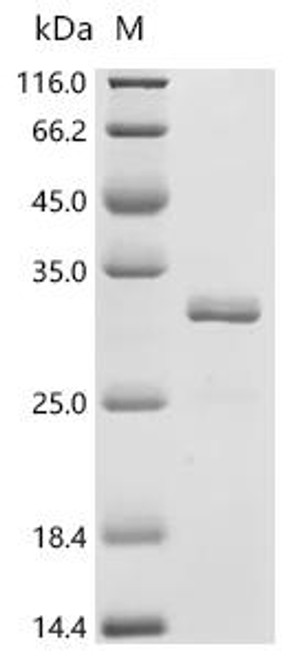 Recombinant Mouse Nitric oxide synthase, endothelial (Nos3), partial (CSB-EP015946MO)