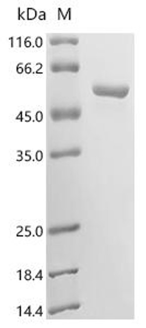 Recombinant Mouse Nitric oxide synthase, inducible (Nos2), partial (CSB-EP015943MO)