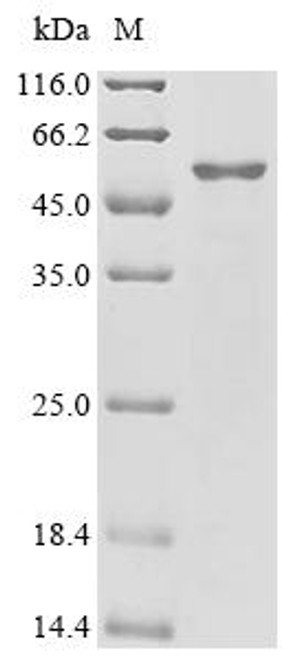 Recombinant Influenza A virus Neuraminidase (NA), partial (CSB-EP6944IOC)
