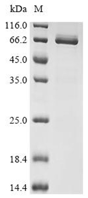 Recombinant Xenopus laevis Bic-C protein (Bic-C) (H140A,S141A), partial (CSB-EP6418XBE(M)) Recombinant Xenopus laevis Bic-C protein (Bic-C) (H140A,S141A), partial (CSB-EP6418XBE(M))