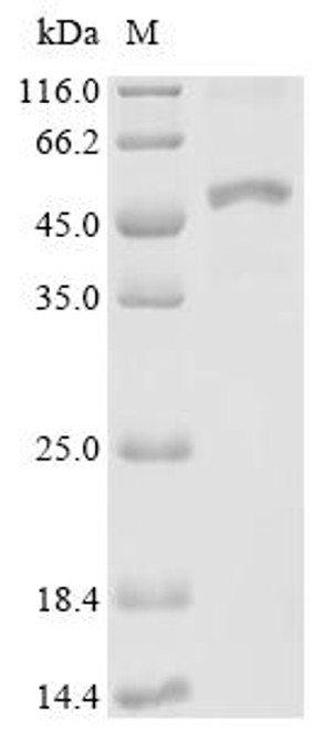 Recombinant Plasmodium falciparum Merozoite surface protein 1 (MSP1), partial (CSB-EP361416EWT1) Recombinant Plasmodium falciparum Merozoite surface protein 1 (MSP1), partial (CSB-EP361416EWT1)