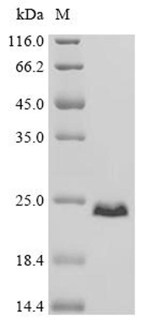 Recombinant Human Myristoylated alanine-rich C-kinase substrate (MARCKS), partial (CSB-EP013493HU1) Recombinant Human Myristoylated alanine-rich C-kinase substrate (MARCKS), partial (CSB-EP013493HU1)