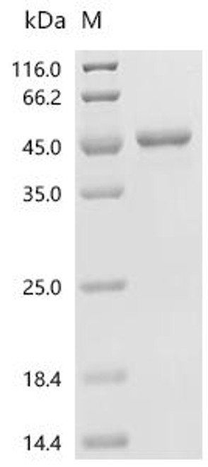 Recombinant Neisseria gonorrhoeae Glyceraldehyde-3-phosphate dehydrogenase (gapA) (CSB-EP6458NGA) Recombinant Neisseria gonorrhoeae Glyceraldehyde-3-phosphate dehydrogenase (gapA) (CSB-EP6458NGA)