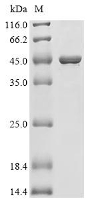 Recombinant Human UMP-CMP kinase 2, mitochondrial (CMPK2) (CSB-EP688686HU) Recombinant Human UMP-CMP kinase 2, mitochondrial (CMPK2) (CSB-EP688686HU)