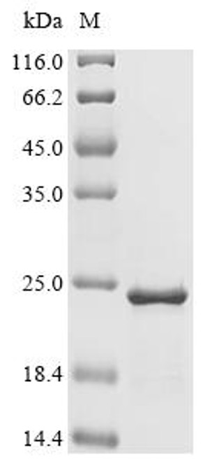 Recombinant Human Tubulin-specific chaperone A (TBCA) (CSB-EP023225HU)