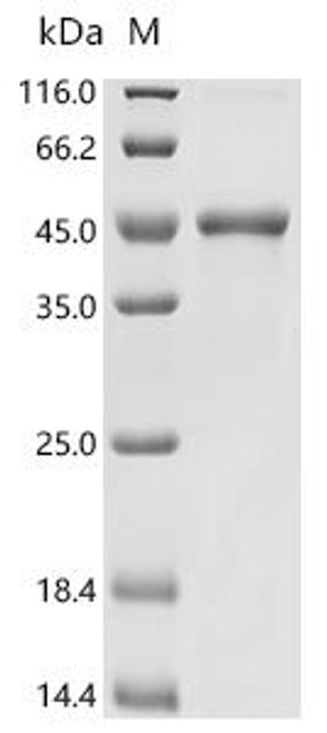 Recombinant Candida albicans Secreted aspartic protease 5 (SAP5) (CSB-EP337319CZD)