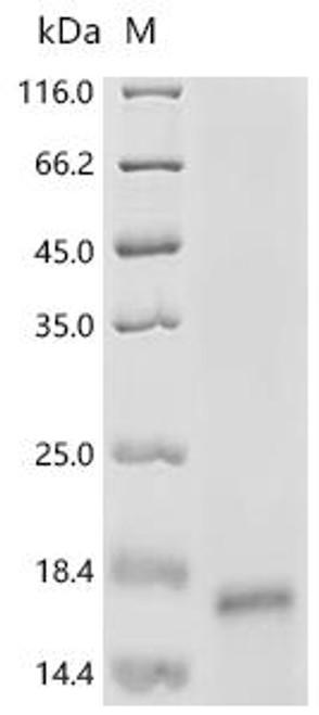 Recombinant Mouse Mas-related G-protein coupled receptor member B2 (Mrgprb2), partial (CSB-YP665973MO1)