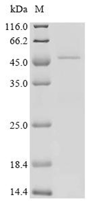 Recombinant Human Transforming growth factor beta regulator 1 (TBRG1) (CSB-YP023243HU)