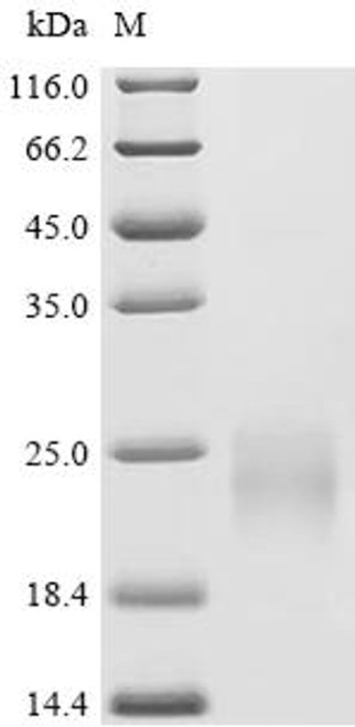 Recombinant Mouse Sorcin (Sri) (CSB-MP022665MO)
