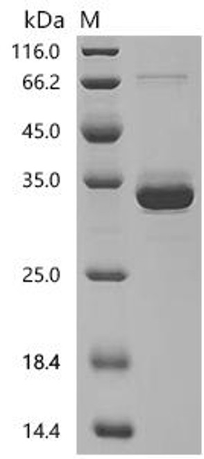 Recombinant Mouse Endothelin-2 (Edn2), partial (CSB-MP007401MO)