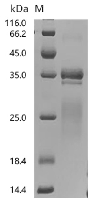 Recombinant Human Repulsive guidance molecule A (RGMA), partial (CSB-MP836186HU1)