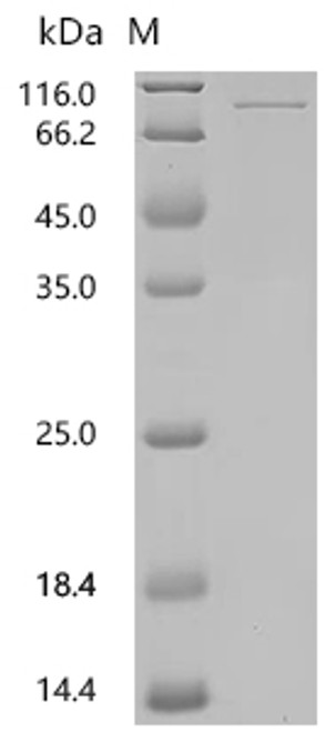 Recombinant Mouse Coagulation factor XI  (F11) (CSB-MP007916MO(A4))