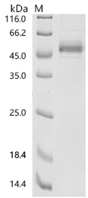 Recombinant Human Lymphocyte antigen 6K (LY6K) (CSB-MP621061HUh8)