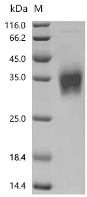 Recombinant Mouse Interferon beta (Ifnb1) (CSB-MP011048MO)