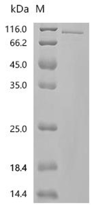 Recombinant Human Glucocorticoid receptor (NR3C1), partial (CSB-MP016059HU1)