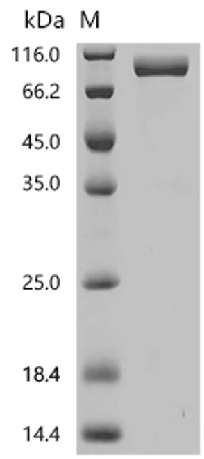 Recombinant Macaca mulatta Interleukin 23 receptor (IL23R), partial (CSB-MP6762MOV)