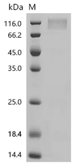 Recombinant Human Mucin-16 (MUC16), partial, Biotinylated (CSB-MP704410HU3j7-B)