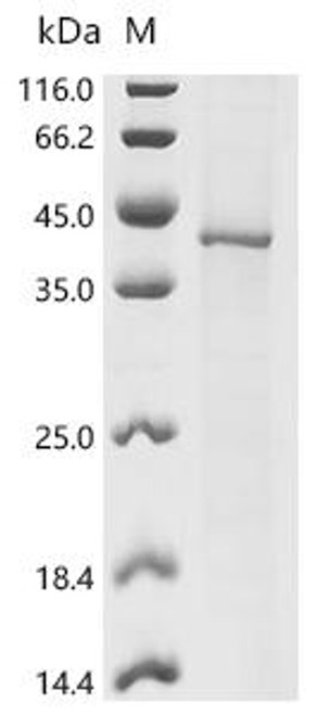 Recombinant Human Sphingosine 1-phosphate receptor 5 (S1PR5) (CSB-CF867132HU)