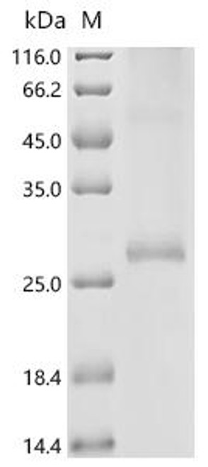 Recombinant Rat Tetraspanin-1 (Tspan1) (CSB-CF734910RA)