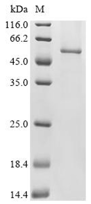 Recombinant Lassa virus Pre-glycoprotein polyprotein GP complex (GPC) (CSB-CF362480LNP)