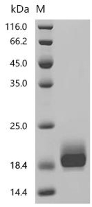 Recombinant Macaca mulatta Interleukin-2 (IL2) (CSB-MP011629MOW)