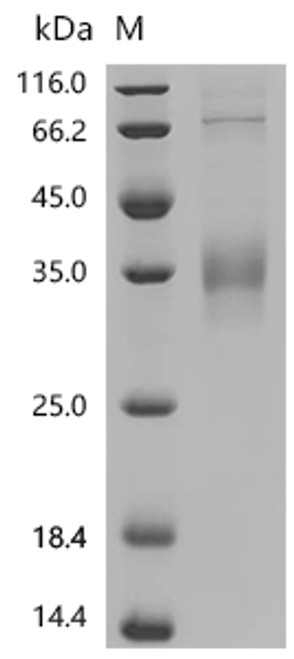 Recombinant Human GTPase NRas (NRAS) (CSB-MP016070HU)
