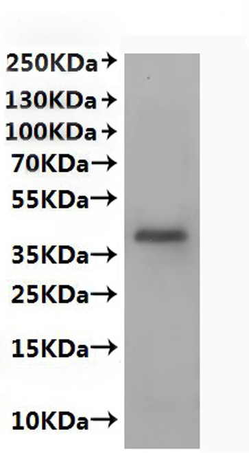 Recombinant Human C-X-C chemokine receptor type 2 (CXCR2)-VLPs (CSB-MP011673HU(A4))