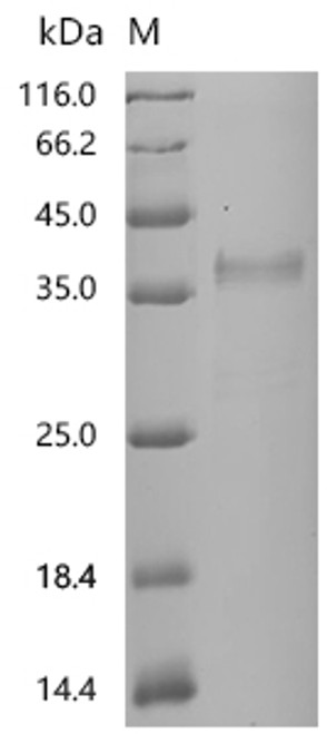 Recombinant Human Apolipoprotein E (APOE) (CSB-MP001936HU)