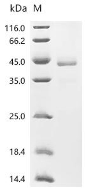 Recombinant Mouse Inhibin beta B chain (Inhbb) (CSB-MP011720MO)