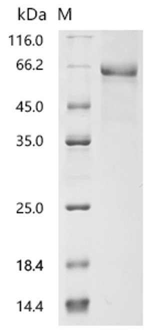 Recombinant Human Apolipoprotein E (APOE) (CSB-MP001936HUd9)