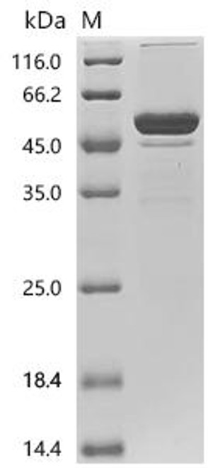 Recombinant Mouse Fibroblast growth factor 21 (Fgf21) (CSB-MP008627MO)