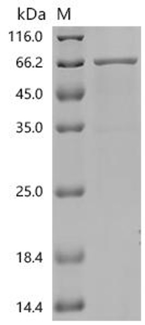 Recombinant Mouse Angiopoietin-related protein 2 (Angptl2) (CSB-MP865621MO)