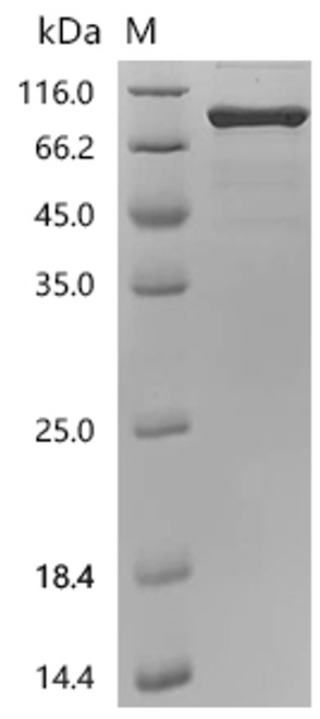 Recombinant Mouse Bone morphogenetic protein 2 (Bmp2) (CSB-MP002736MOr13)