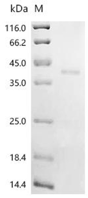 Recombinant Mouse Transforming growth factor beta-1 proprotein (Tgfb1), partial (CSB-MP023446MO)