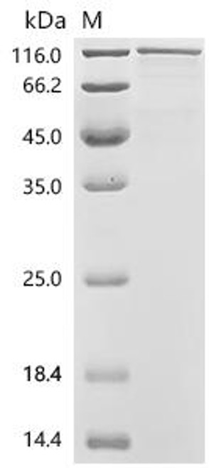 Recombinant Mouse Protein Wnt-10a (Wnt10a) (CSB-MP026129MO)