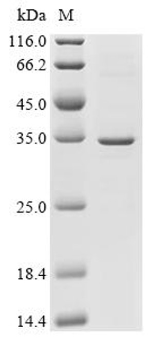 Recombinant Human Serine/threonine-protein phosphatase PGAM5,mitochondrial (PGAM5) (G166A,V167A,K169A) (CSB-CF839338HU(A4)(M))