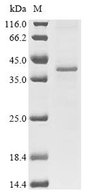 Recombinant Mouse C-C chemokine receptor type 4 (Ccr4) (CSB-CF004843MO) Recombinant Mouse C-C chemokine receptor type 4 (Ccr4) (CSB-CF004843MO)