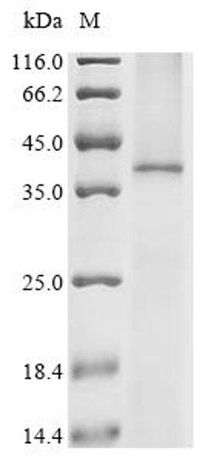 Recombinant Human C-X-C chemokine receptor type 1 (CXCR1) (CSB-CF011672HUa0) Recombinant Human C-X-C chemokine receptor type 1 (CXCR1) (CSB-CF011672HUa0)