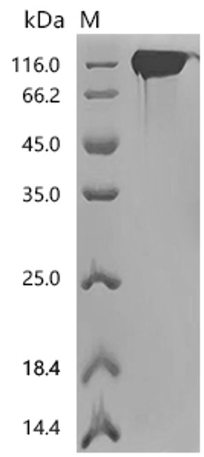 Recombinant Human Cell adhesion molecule CEACAM5 (CEACAM5) (E398K), Biotinylated (CSB-MP005165HU(M)-B) Recombinant Human Cell adhesion molecule CEACAM5 (CEACAM5) (E398K), Biotinylated (CSB-MP005165HU(M)-B)
