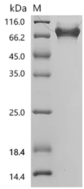 Recombinant Macaca fascicularis Interleukin-2 receptor subunit alpha (IL2RA), partial (CSB-MP5104MOVd9) Recombinant Macaca fascicularis Interleukin-2 receptor subunit alpha (IL2RA), partial (CSB-MP5104MOVd9)