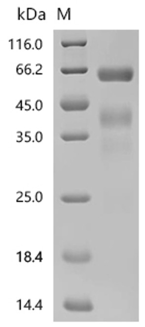 Recombinant Macaca mulatta Interferon gamma (IFNG) (CSB-MP011050MOWr12) Recombinant Macaca mulatta Interferon gamma (IFNG) (CSB-MP011050MOWr12)
