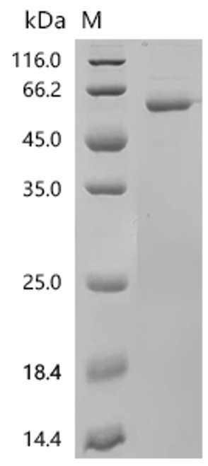 Recombinant Human Erythropoietin receptor (EPOR), partical (CSB-MP007744HU1d9) Recombinant Human Erythropoietin receptor (EPOR), partical (CSB-MP007744HU1d9)